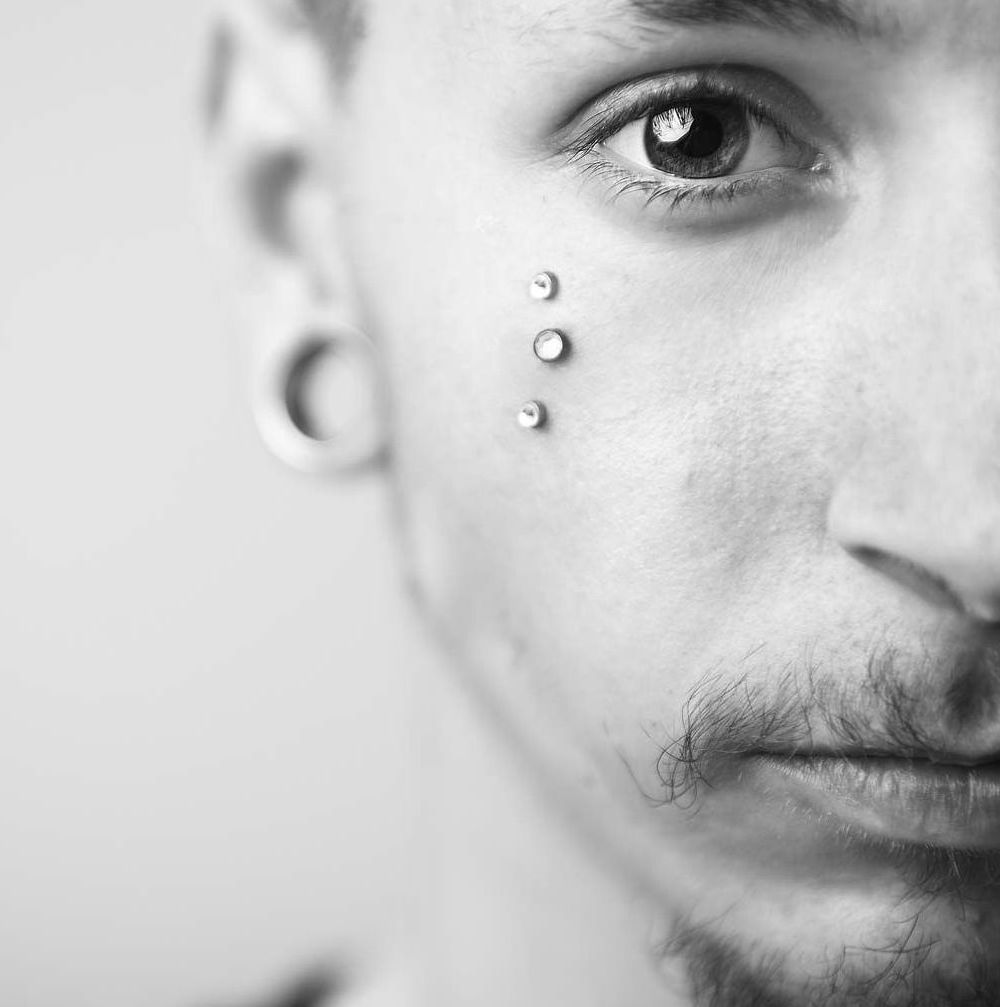 Gesichtsimplantat
